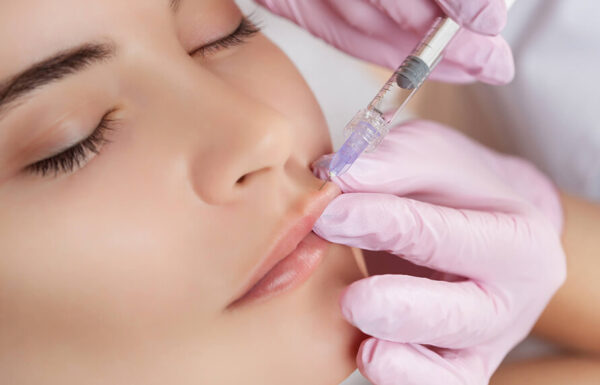 Lip Augmentation